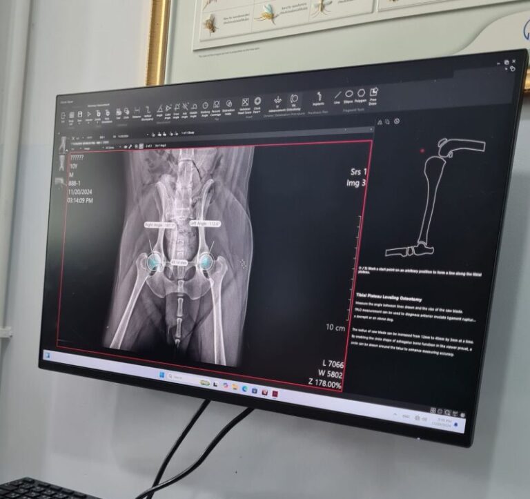 โปรแกรมช่วยวินิฉัย X-Ray Digital (DR)
